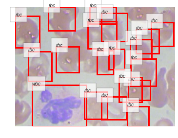 ../_images/notebooks_06_Blood_Cell_Detection_29_0.png