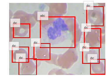 ../_images/notebooks_06_Blood_Cell_Detection_67_0.png