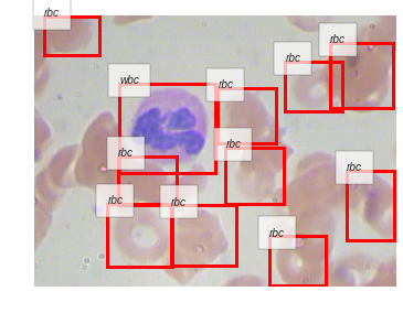 ../_images/notebooks_06_Blood_Cell_Detection_69_11.png