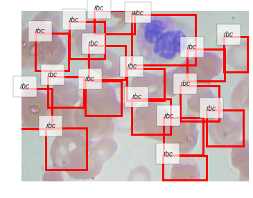 ../_images/notebooks_06_Blood_Cell_Detection_69_14.png