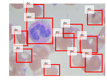 ../_images/notebooks_06_Blood_Cell_Detection_69_17.png