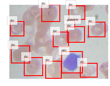 ../_images/notebooks_06_Blood_Cell_Detection_69_20.png