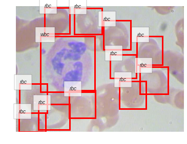 ../_images/notebooks_06_Blood_Cell_Detection_69_5.png